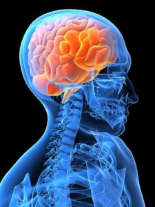 organic brain syndrome