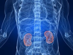 renal failure